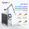 Máquina a laser Q-Switched ND YAG para remoção de tatuagem Máquina a laser Q-Switched ND YAG