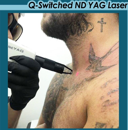 Equipamento laser qs 1