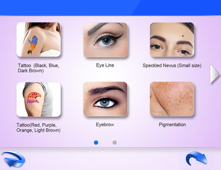 Qs laser screen 1 Tela laser Qs 1