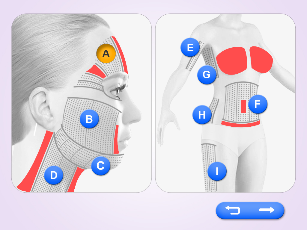 Multi-linhas HIFU HS-511