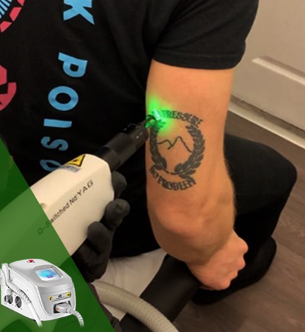 Equipamento laser QS 2 