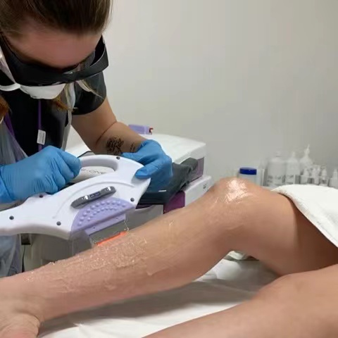 Quanto custa a remoção do cabelo a laser