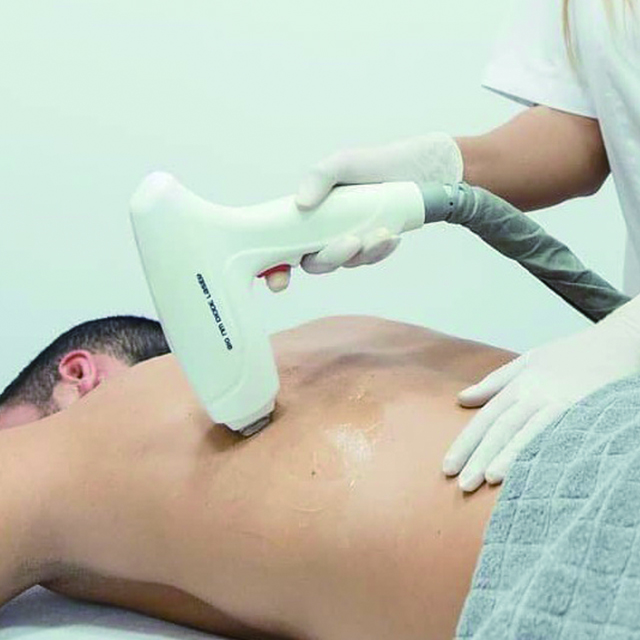 depila&ccedil;&atilde;o