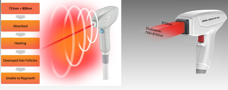 equipamento de laser de diodo
