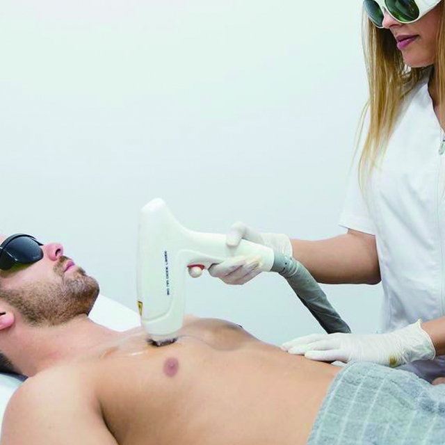 Laser de remo&ccedil;&atilde;o de cabelo