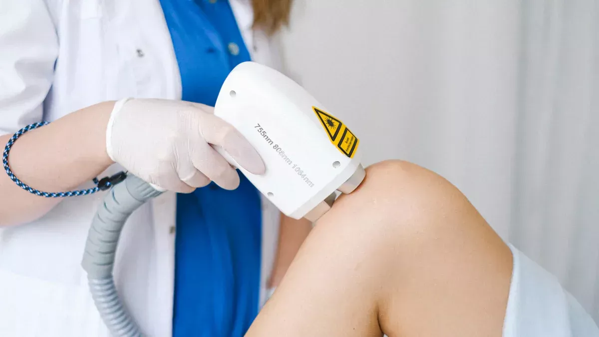 Que tipos de cabelo não podem ser laserados