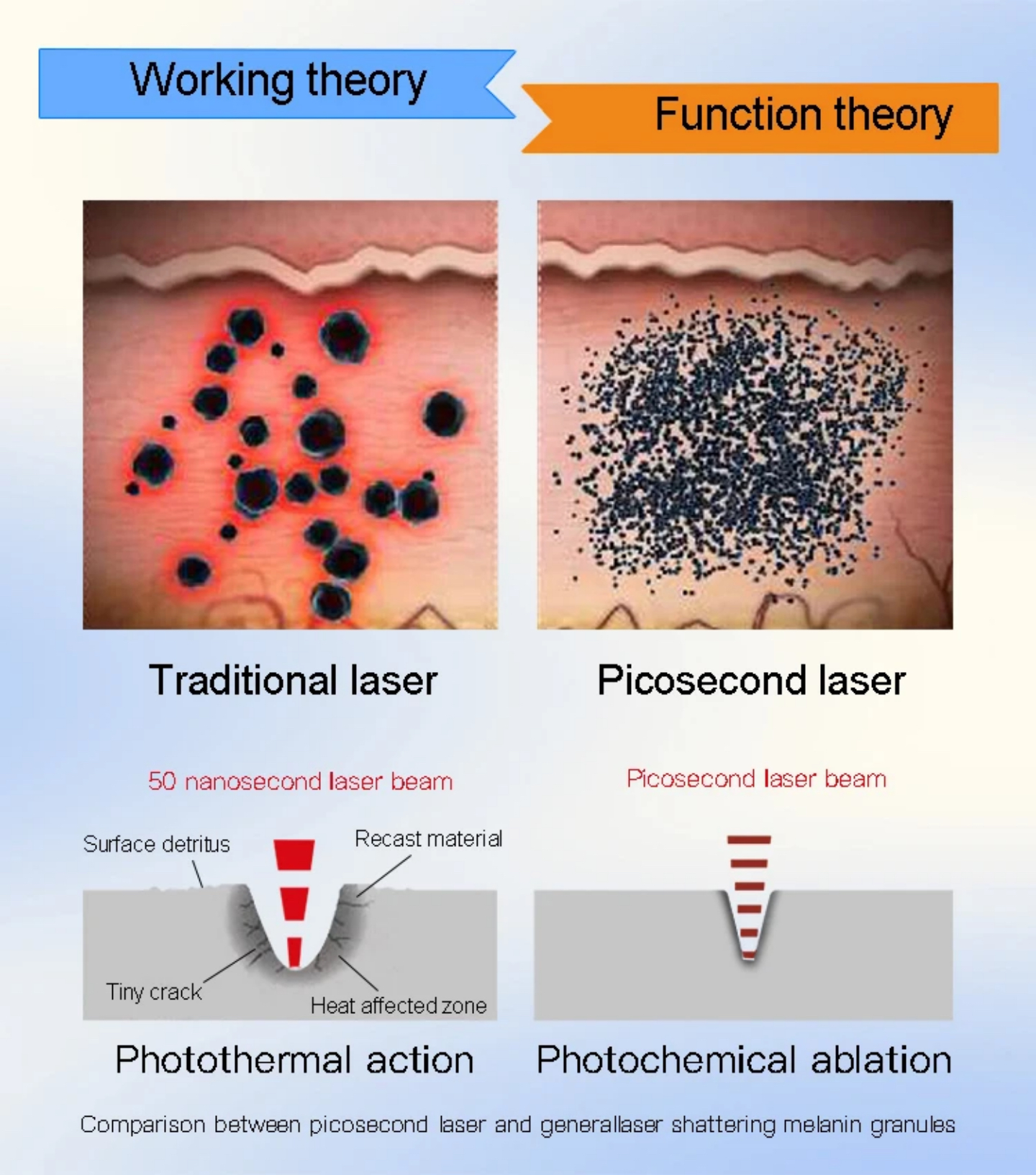 Qual é a ciência por trás da remoção de tatuagens a laser?
