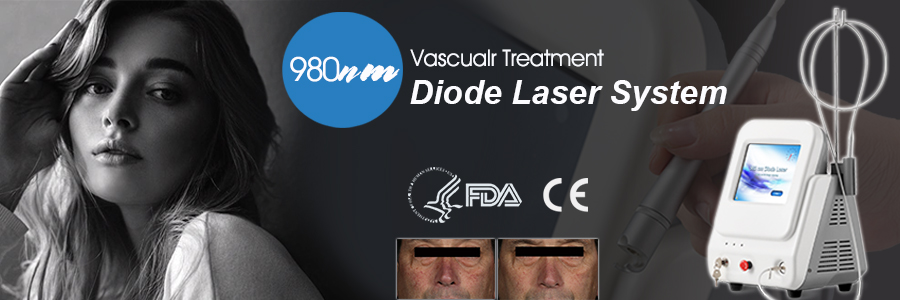 dispositivo laser de diodo de remo&ccedil;&atilde;o vascular 980nm