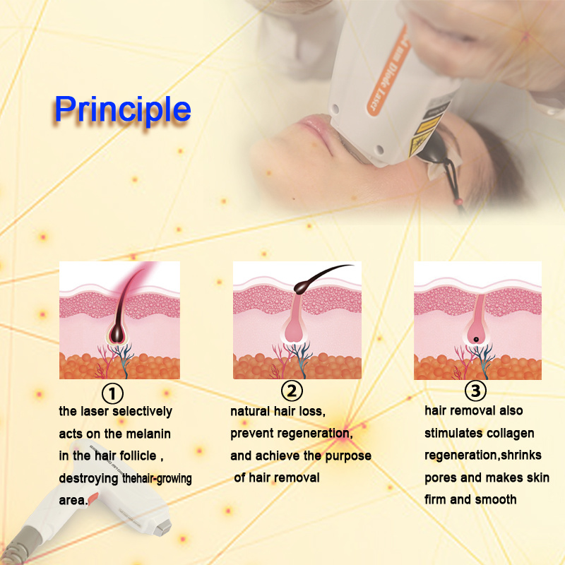 m&aacute;quina a laser de 810 diodos