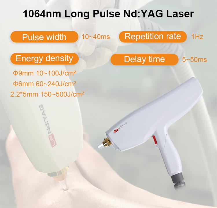 pe&ccedil;a de m&atilde;o a laser de pulso longo